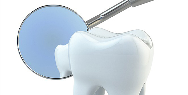 入れ歯やブリッジとの違い